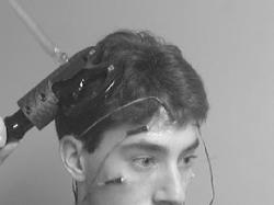 A volunteer models the TMS device which is worn over the front of the head to stimulate the underlying brain tissue