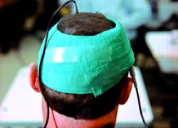 Testing tDCS against dementia (Image: Marc Asnin/New Scientist)